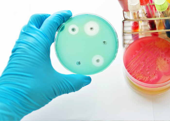 Antimicrobial Susceptibility Testing